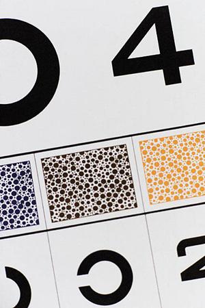 札幌で受けられるオールオン4とは